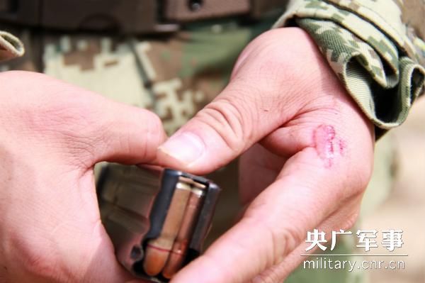 图为官兵在训练时手破皮。