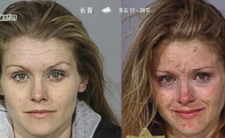 触目惊心！看瘾君子吸毒前后面容对比